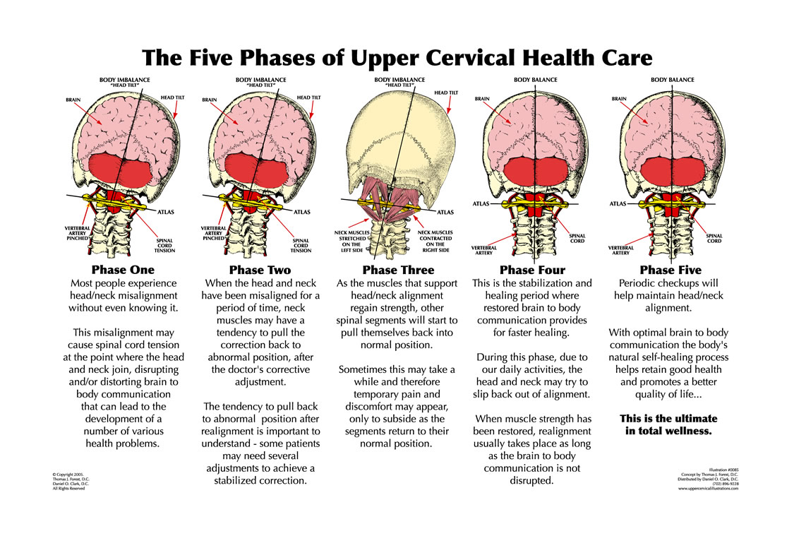 THE FIVE PHASES OF UPPER CERVICAL HEALTH CARE